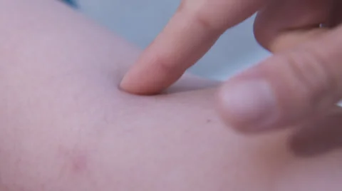 Vein probe Video stock 26081941