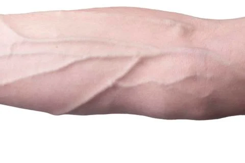 Veins on an arm Stock Photos