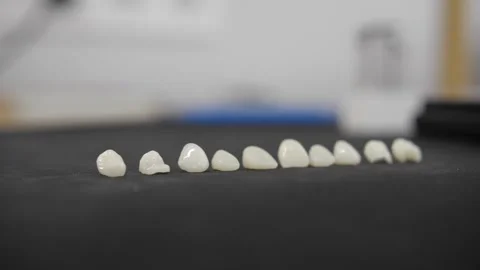 Veneers in dentistry. Artificial teeth Stockbeeldmateriaal 152516305