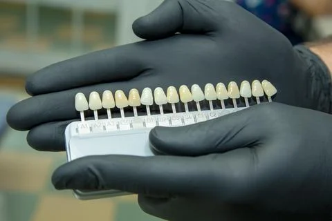 Veneers for teeth Stock Photos