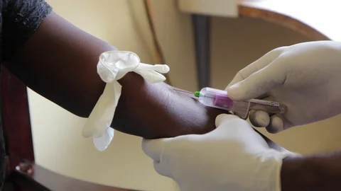 Venipuncture at a clinic in Uganda 스톡 동영상 102207280