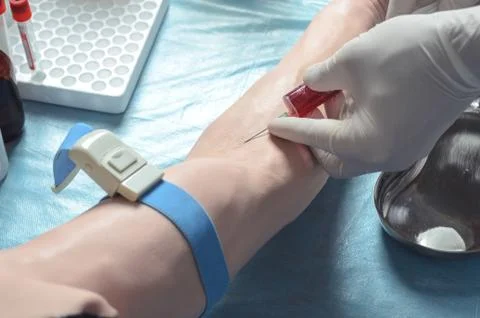 Venipuncture Stock Photos