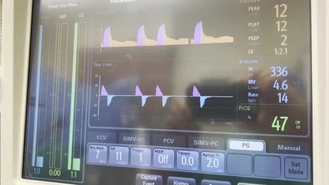 Ventilator vitals screenshot Video stock 164046977