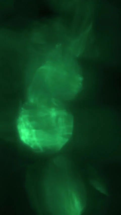 Vertical Abstract Green Bokeh Light Leak Background With Gentle Movement Stock Footage 330196144