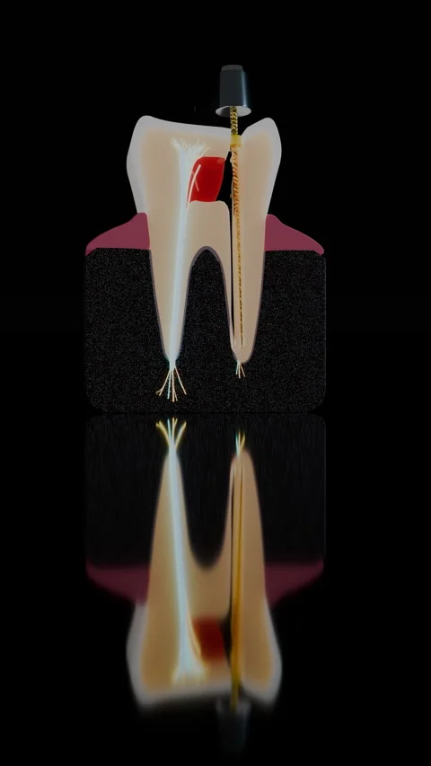 Vertical anatomical tooth cross section with dental rotary, Vertical 9:16 4K Stock Footage 346120547