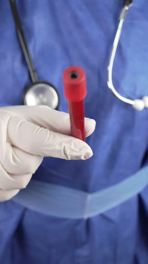 Vertical Close Up of Blood Sample Tube in White Gloved Hand Stock Footage 340550667