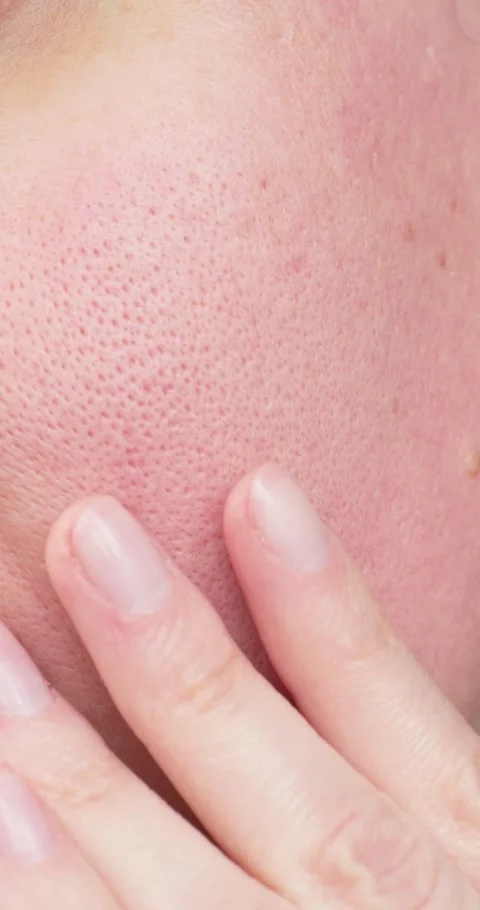 Vertical. close-up of skin magnification, pore structure and epidermis details Stock Footage 305312510