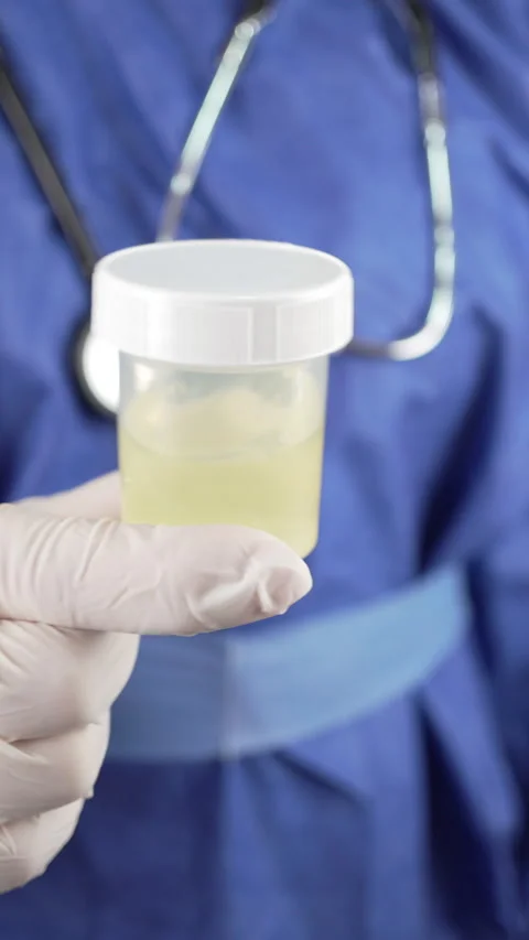 Vertical Detail of Urine Sample Cup in Gloved Hand Stock Footage 341175328