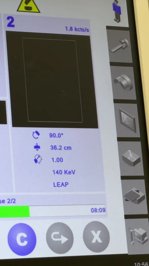 Vertical. Medical computer screen showing kidney function. Video stock 342275962