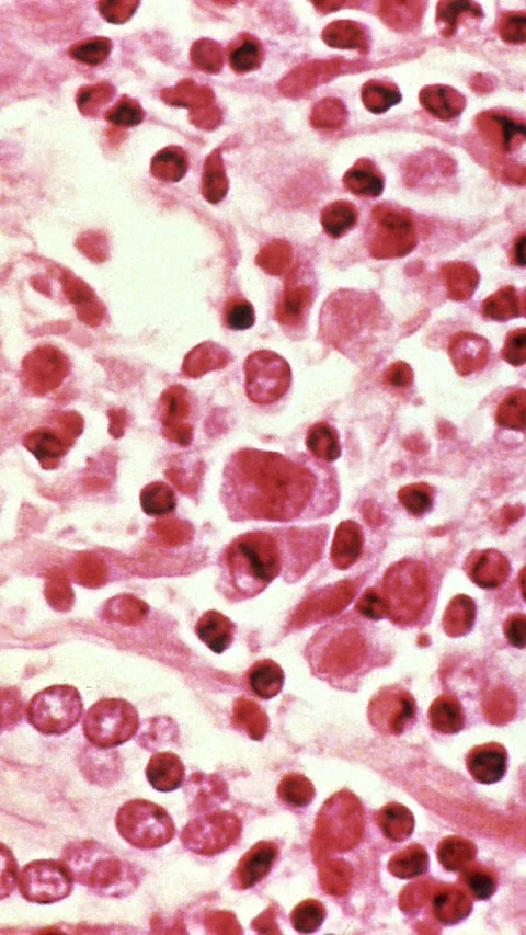 Vertical microscopic illustration of Hanta virus - Soft zoom out Stockbeeldmateriaal 334736659