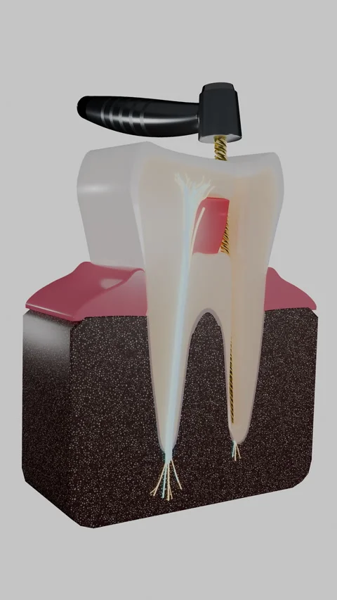 Vertical molar cross section with dental handpiece and root, Vertical 9:16 4K Stock Footage 346121413