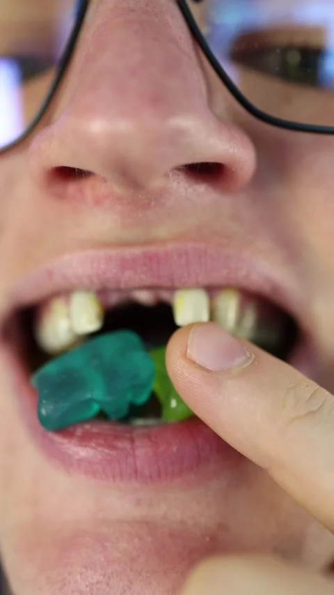 Vertical screen candy damage close-up of decayed and missing teeth while chewing Stock Footage 312200255