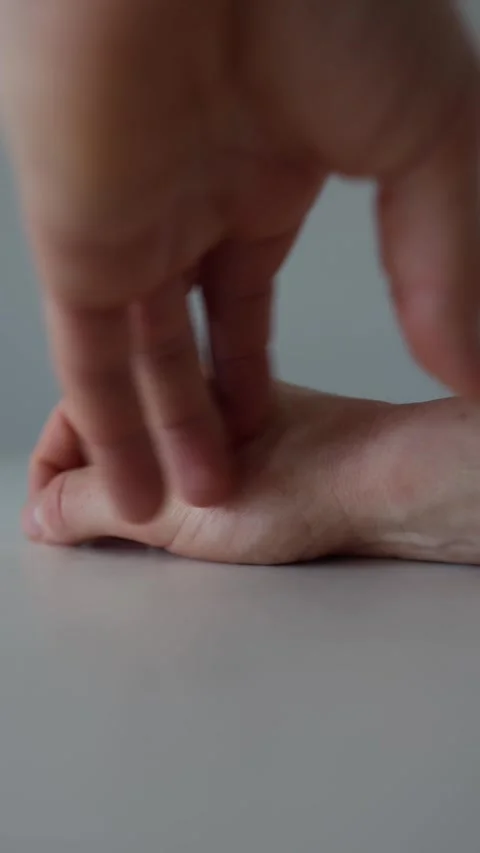 Vertical screen: A close-up of a hand with red skin irritation, as another hand  Video stock 304622981