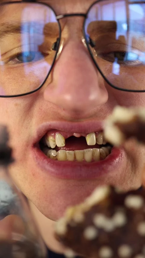 Vertical screen closeup of rotting teeth young man shows severe dental decay whi Video stock 312195830