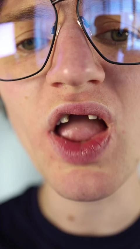 Vertical screen drinking dark soda closeup young man with glasses presses bottle Stock Footage 312195947