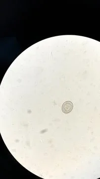 Vertical shot of a parasite Foto stock