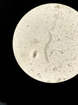 Vertical shot of a parasite Stock Photos