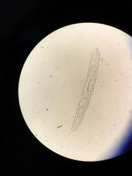 Vertical shot of a parasite Stockfoto's
