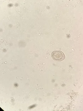 Vertical shot of a parasite Stock Photos