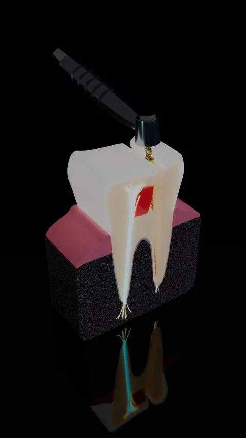 Vertical studio composition of molar root canal cross section, Vertical 9:16 4K Stock Footage 346120540