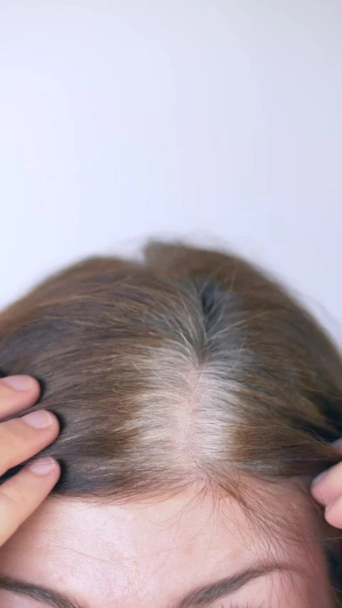 Vertical video. Close view of gray hair at the scalp as woman reveals gray hairs Stock Footage 322616781