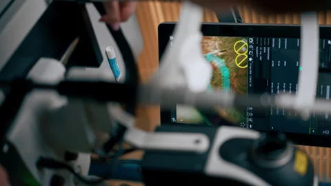 Vertical video diagnostic screen with image the eye indicator of moisture and Stock Footage 276858848