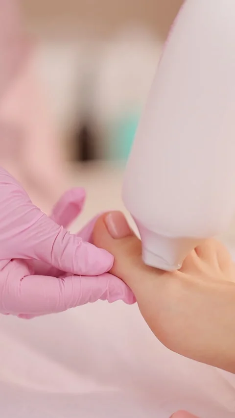 Vertical Video of The doctor makes the procedure for the treatment of foot Stock Footage 306320487