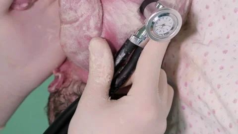 Vertical video. The doctor's hands hold a stethoscope to the body of a newborn Video stock 248906597