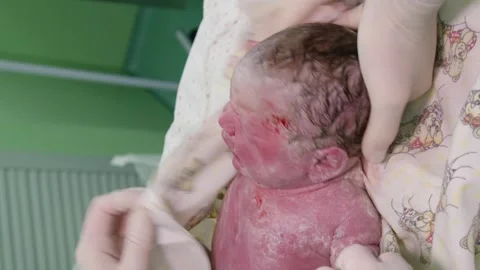 Vertical video. A doctor's hands wipe a newborn baby from the remnants of fetal Video stock 248906629