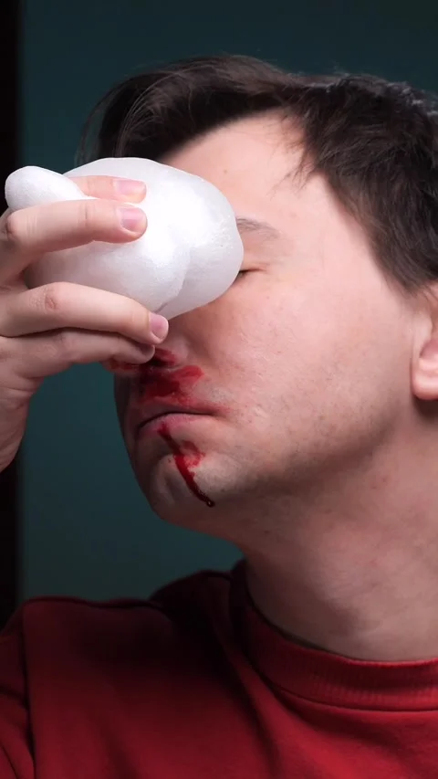 Vertical video Man using ice pack on nose to stop bleeding after injury Stock Footage 304738586