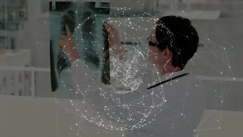 Vertical video: Med Dr holding chest Xray up pointing left lung network pulsing Stock Footage 331269717