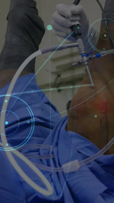 Vertical video: Surgeon inserting scope into knee, guiding tubing with HUD Stockbeeldmateriaal 331009322