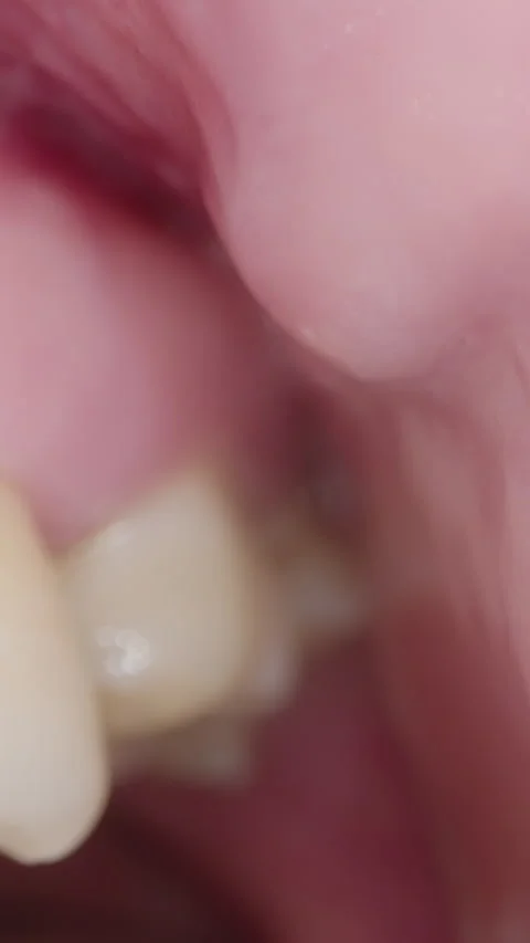 dental-on-mouth-view-stock-footage-royalty-free-stock-videos-pond5