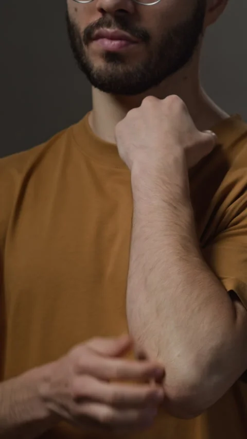 Vertical of Young Man Scratching Elbow Suffering from Skin Issues Stock Footage 322518017