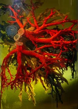 Vessels of the human circulatory system in formaldehyde solution closeup Stock Photos