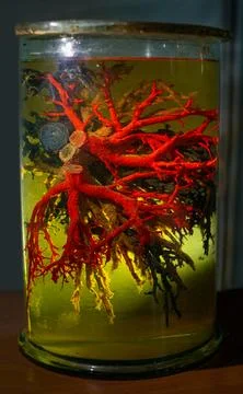 Vessels of the human circulatory system in formaldehyde solution closeup Stock Photos