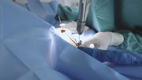 Veterinarian doing a traumatology operation. Stock Footage