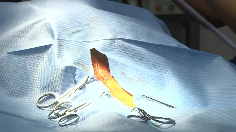 Veterinary Surgeon Performing Surgical Procedure on Dog Vídeos de archivo 343882112