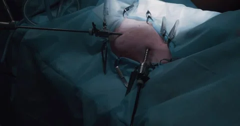 A veterinary surgeon performs a complex endoscopic operation on a pet under Stock Footage 278730240