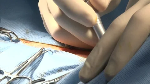 Veterinary Surgeon Working With Surgical Instruments Vídeos de archivo 343877418
