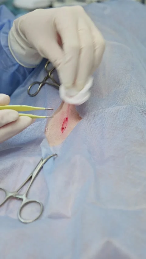 Veterinary surgeon's hands in sterile gloves performing a spaying operation on a Stock Footage 341704619