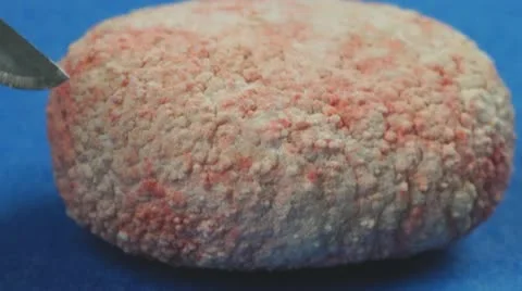 Veterinary Surgery Bladder Stone Stock Footage 22040203