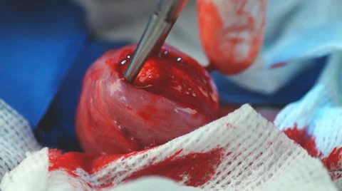 Veterinary Surgery Bladder Stone Stock Footage 22040421