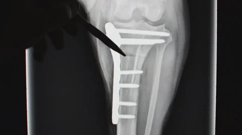 Veterinary Surgery Knee 스톡 동영상 35515383