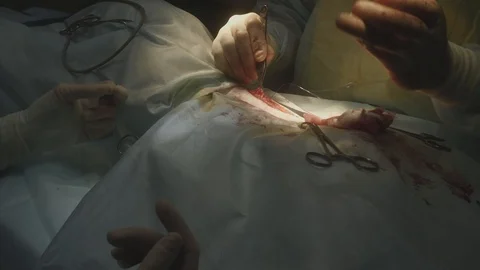 Veterinary surgery at a pet clinic. 動画素材 88281112