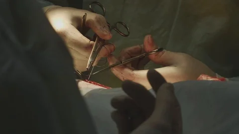 Veterinary surgery at a pet clinic. Vidéo 88281142