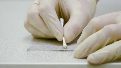 Vet's hands transfering a sample from a cotton swab to glass for microscope. 4K Video stock 97178875
