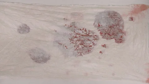 VFX element of blood seeping through fabric. Could be used for a bleeding Stock Footage 92455518