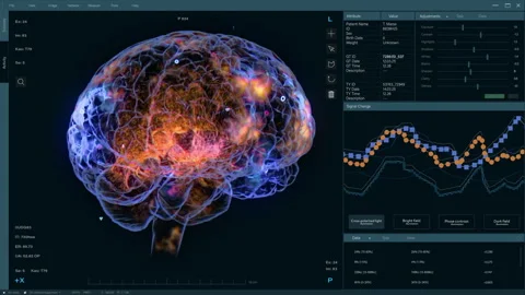 VFX Interface Of Medical Software With Brain Scan Stock Footage 283752895