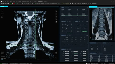 VFX Mediacal MRI Software Interface With Spinal Cord Stock Footage 243809592